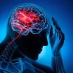 Un nuevo análisis de sangre podría detectar un tipo peligroso de accidente cerebrovascular